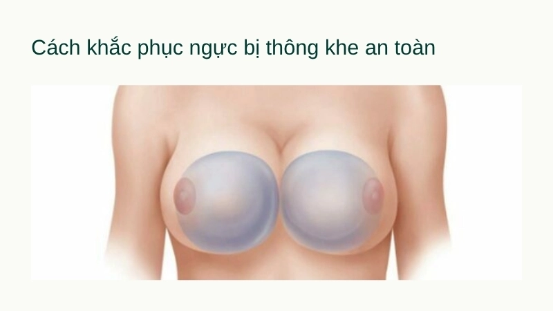 Cách khắc phục ngực bị thông khe an toàn