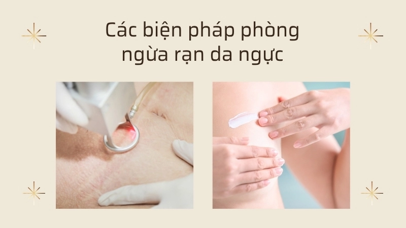 Các biện pháp phòng ngừa rạn da ngực