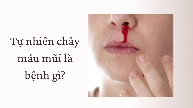 Tự nhiên chảy máu mũi là bệnh gì?
