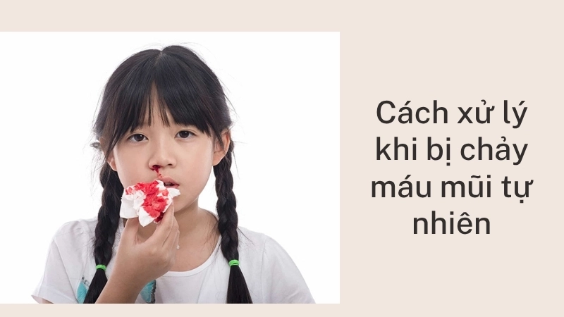 Cách xử lý khi bị chảy máu mũi tự nhiên