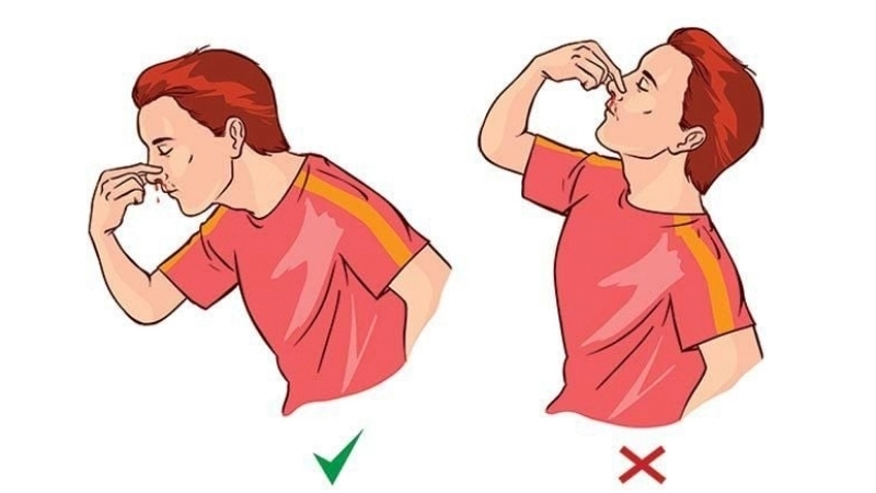 Biện pháp phòng ngừa chảy máu mũi