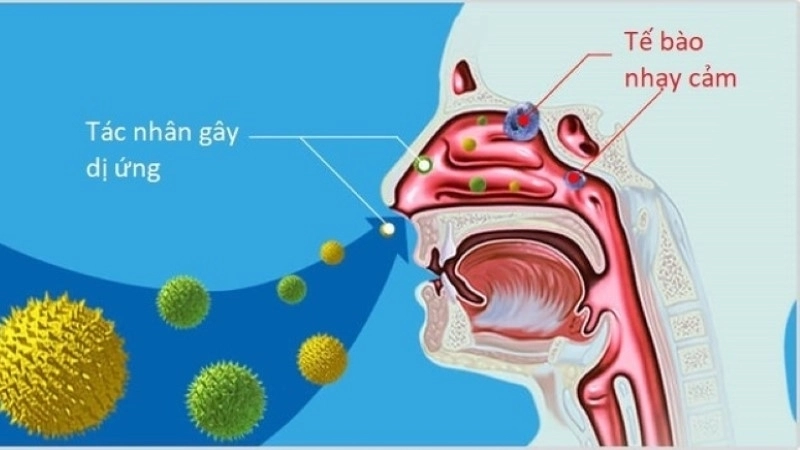 Tránh tiếp xúc với các tác nhân gây kích ứng niêm mạc mũi