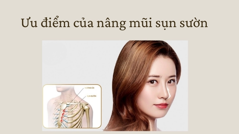 Ưu điểm của nâng mũi sụn sườn