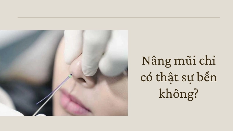 Nâng mũi chỉ có thật sự bền không?